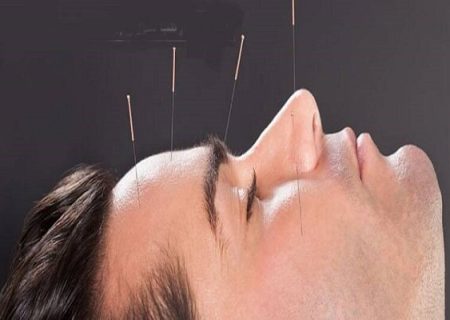 طب سوزنی کدام بیماری‌ها را درمان می‌کند